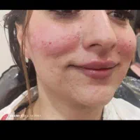 جشنواره تزریق بوتاکس وژل. فیلرکل صورت از ۷میلیون|خدمات آرایشگری و زیبایی|بردسیر, |دیوار