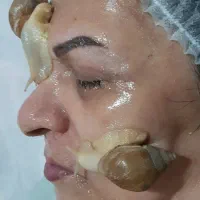 حلزون آچاتینا آلبینو|خزنده|همدان, |دیوار