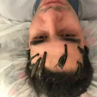 مشاوره حجامت و بادکش گرم زالو فصد خون امبدینگ