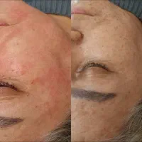 پزشکی آف ویژه