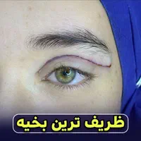 لیپو ابدو کاشت مو ابرو تزریق چربی ژل بوتاکس بلفارو|خدمات آرایشگری و زیبایی|اهواز, نادری|دیوار