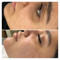 فیشال،پاکسازی