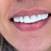 تخفیف ویژه کامپوزیت یلدایی|خدمات آرایشگری و زیبایی|شیراز, قصرالدشت|دیوار