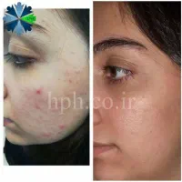 مشاوره رایگان پوست و مو + معرفی روتین اختصاصی