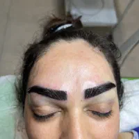 کاشت ابرو و‌مو طبیعی