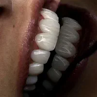 مدل کامپوزیت لیرینگ|خدمات آرایشگری و زیبایی|تهران, اباذر|دیوار