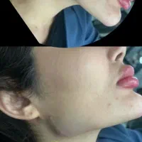 ژل بوتاکس 550|خدمات آرایشگری و زیبایی|پرند, فاز ۵|دیوار