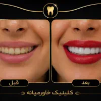 بزرگترین جشنواره سال دندانپزشکی درمجهزترین کلینیک|خدمات زیبایی و سلامت|شیراز, عفیف‌آباد|دیوار