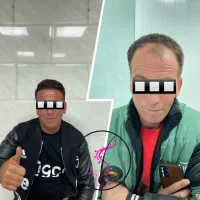 کاشت موی تخصصی زیر نظر پزشک متخصص