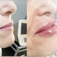 پکیج اقساطی چهره هارمونیک