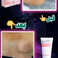 پکیج روشن کننده بدن گاتیو تضمینی (اصلی)|آرایشی، بهداشتی، درمانی|مشهد, جنت|دیوار