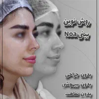 فرمدهی بینی Noa بدون عملDrپوست مو ابرو غبغب زیبایی