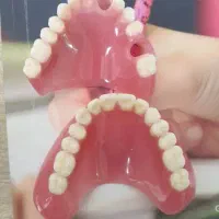 دندانسازی سپیددنتال|آرایشی، بهداشتی، درمانی|خرم‌آباد, |دیوار