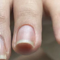 آموزش خدمات ناخن با 50 درصد تخفیف|خدمات آموزشی|نیشابور, ناسیونال|دیوار