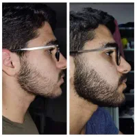 فقط یکبار قبل خواب بزن