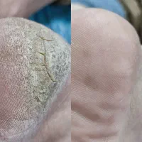 پدیکور خشک و پاکسازی صورت بانوان