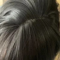 کلاهکیس با فرق پوست سر