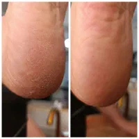 مدل کفسابی پا(محمدیه)