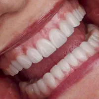 جشنواره ی کلینیک دکتر سلیمانی|خدمات آرایشگری و زیبایی|تهران, شادمان|دیوار