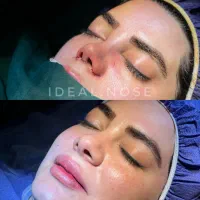 تخفیف ویژە عمل بینی(جشنوارە )|خدمات آرایشگری و زیبایی|نیشابور, خیام|دیوار