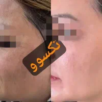 مثل کره چربی بسوزون و به اندام ایده آلت برس