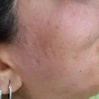 اصلاح صورت و ابرو|خدمات آرایشگری و زیبایی|شوشتر, |دیوار