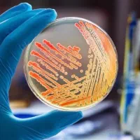 سمینار رایگان میکروبشناسی آزمایشگاه (ظرفیت محدود)