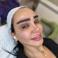 کاشت ابرو متدفاین برو فقط۲۰م