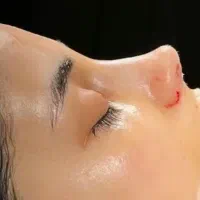 عمل جراحی زیبایی بینی،پلک،لیفت صورت،اندام