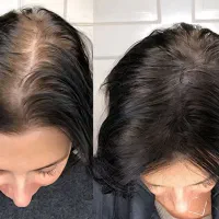 اسکالپ مو،پدیکورپا، خدمات ناخن آنالیز مو رایگان