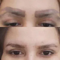 ریموو درمانی تتو های بدرنگ قدیمی