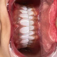 دستیار و منشی دندانپزشکی|استخدام درمانی، زیبایی، بهداشتی|تهران, شاهین|دیوار