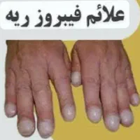 مشاوره طب سنتی برای مشکلات تنفسی|خدمات آرایشگری و زیبایی|رفسنجان, |دیوار