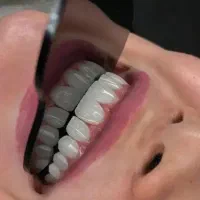 کامپوزیت با ضمانت