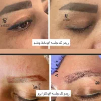 ریموو تتو ابرو و خط چشم در یک جلسه