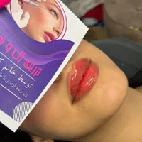 لیفت نخ انزیم ژل وبوتاکس پلاسما تتوبدن فشیال...|خدمات آرایشگری و زیبایی|قم, باجک دو|دیوار