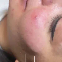 مطب تخصصی پوست مو،زیبایی (برای اقایان ،بانوان)