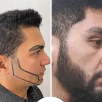 کاشت مو ابرو ریش تارکوب|خدمات آرایشگری و زیبایی|شازند, |دیوار