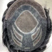 پروتز مو تک و عمده