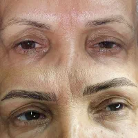 میکروبلیدینگ|خدمات آرایشگری و زیبایی|شیراز, گویم|دیوار