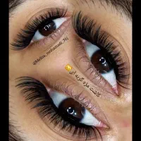 کاشت مژه هیدن