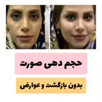 با جوانهگندم بین استار زیبا و تپل شو|حراج|شاهرود, |دیوار