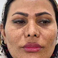 کرم لک سفید کننده فیلیپینی|آرایشی، بهداشتی، درمانی|بندرعباس, |دیوار