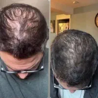 چندتاببریدباتخفیف محصولات درمانی وآرایشی