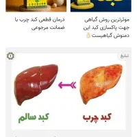 کبد چرب رو جدی بگیرید