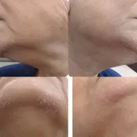 خدمات زیبایی لیزر ، فیشیال ، الکترولیز ، خال|خدمات آرایشگری و زیبایی|شیراز, فرگاز|دیوار