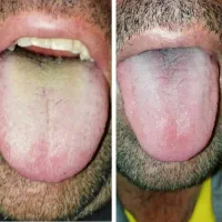 پاکسازی اصولی و ریشه ای بدن