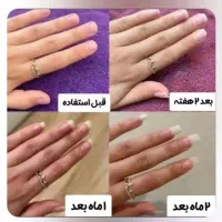 لوسیون و سرم دوفاز ناخن ویتابلا|آرایشی، بهداشتی، درمانی|زاهدان, |دیوار