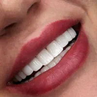 جشنواره دندانپزشکی با بالاترین کیفیت تخفیف