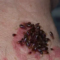 سَمپاشی،سم پاشی ساس منزل حجره ادارات ارگانها پاساژ|خدمات نظافت|کرمان, |دیوار